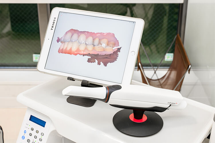 口腔内スキャナー TRIOS 4