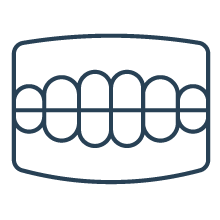 入れ歯（義歯）